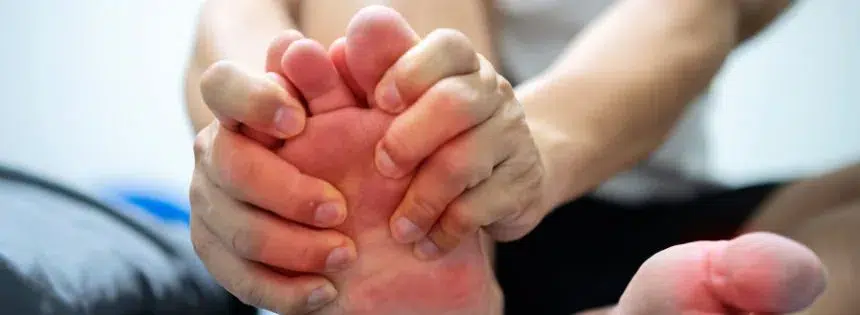 does carnivore cause gout